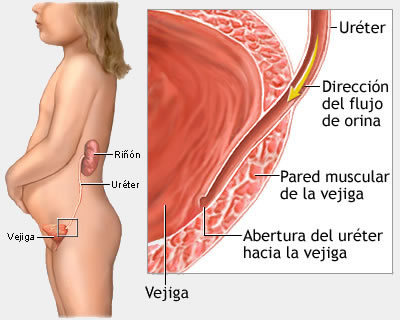 Urología niña